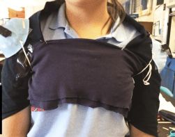 Figure Number 2: OrthoDocs member Zaira wearing the shoulder gear. Photo Credit: Brenda V.